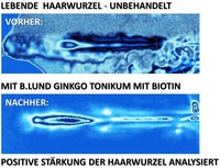 MIT B.LUND GINKGO TONIKUM MIT BIOTIN