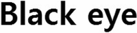 Black eye