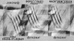 PADMA APRÈS.LE.REPAS DOPO.I.PASTI NACH.DEM.ESSEN
