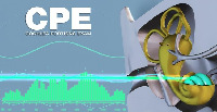 CPE COCHLEA PORTIONS EXAM