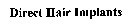 Direct Hair Implants