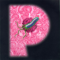 P