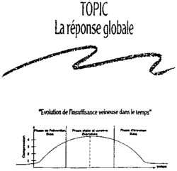 TOPIC La réponse globale