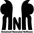 Retained Neonatal Reflexes